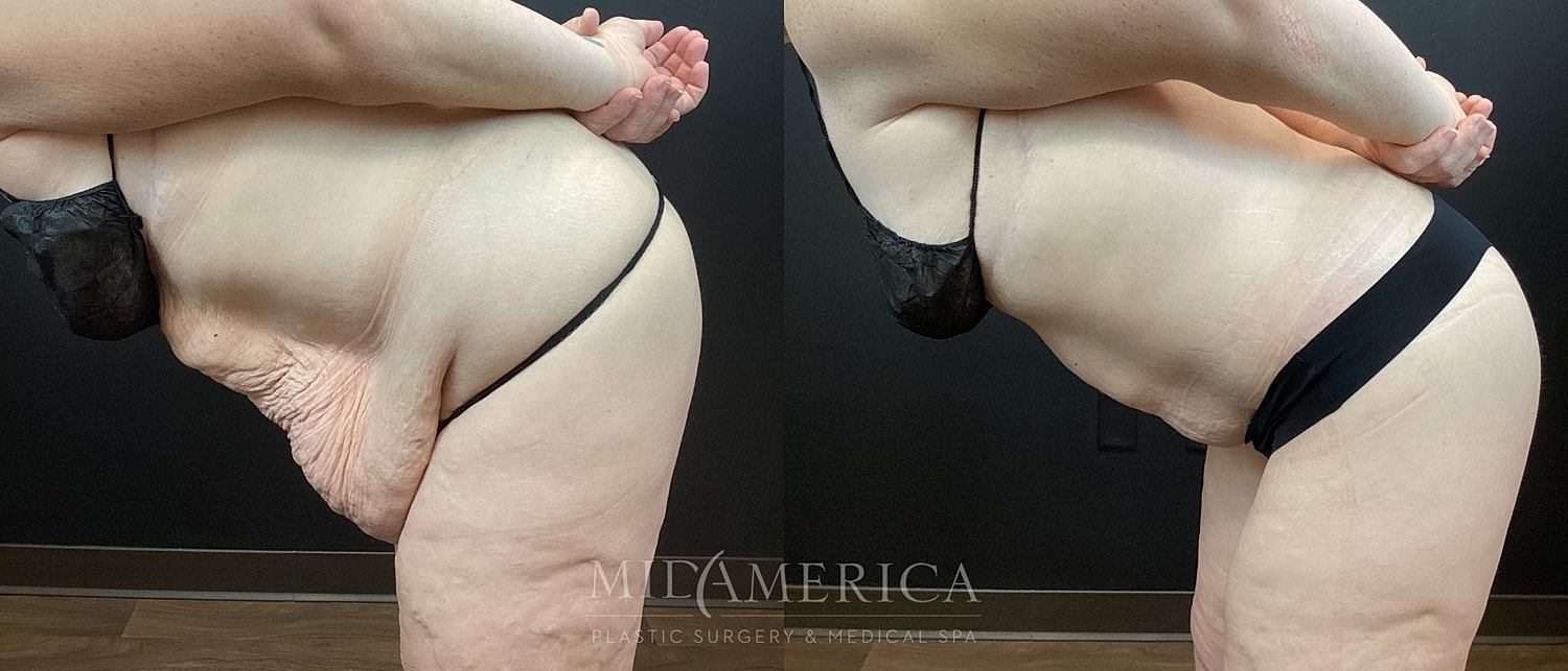 Before and after body transformation photos.