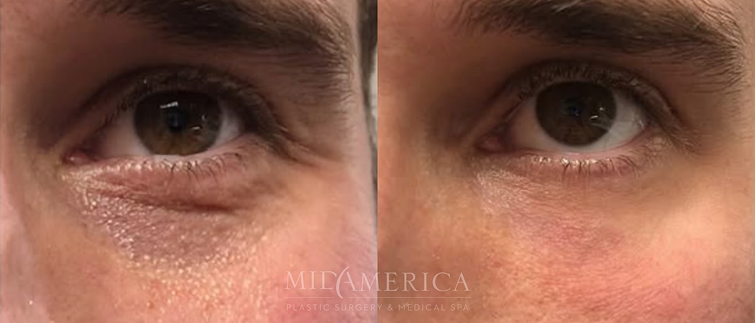 Before and after facial transformation comparison.