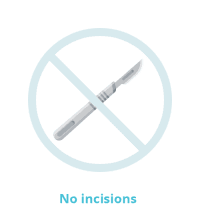 no incisions